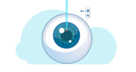 摘镜指南丨从心到身的全面准备：你的近视手术宝藏清单